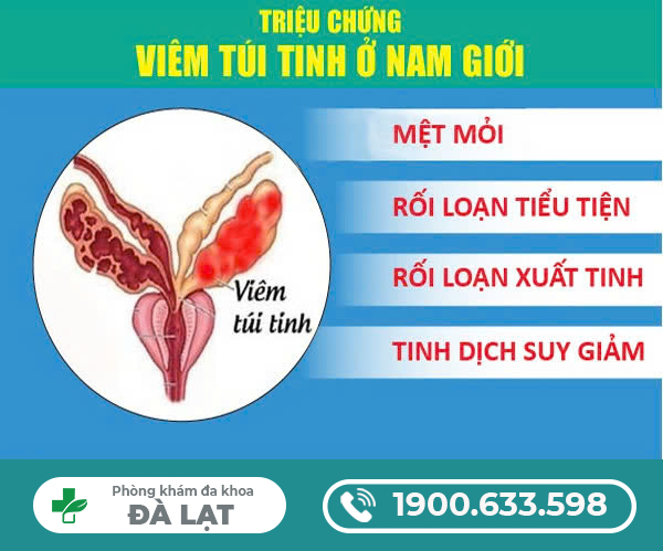 Hình ảnh minh họa